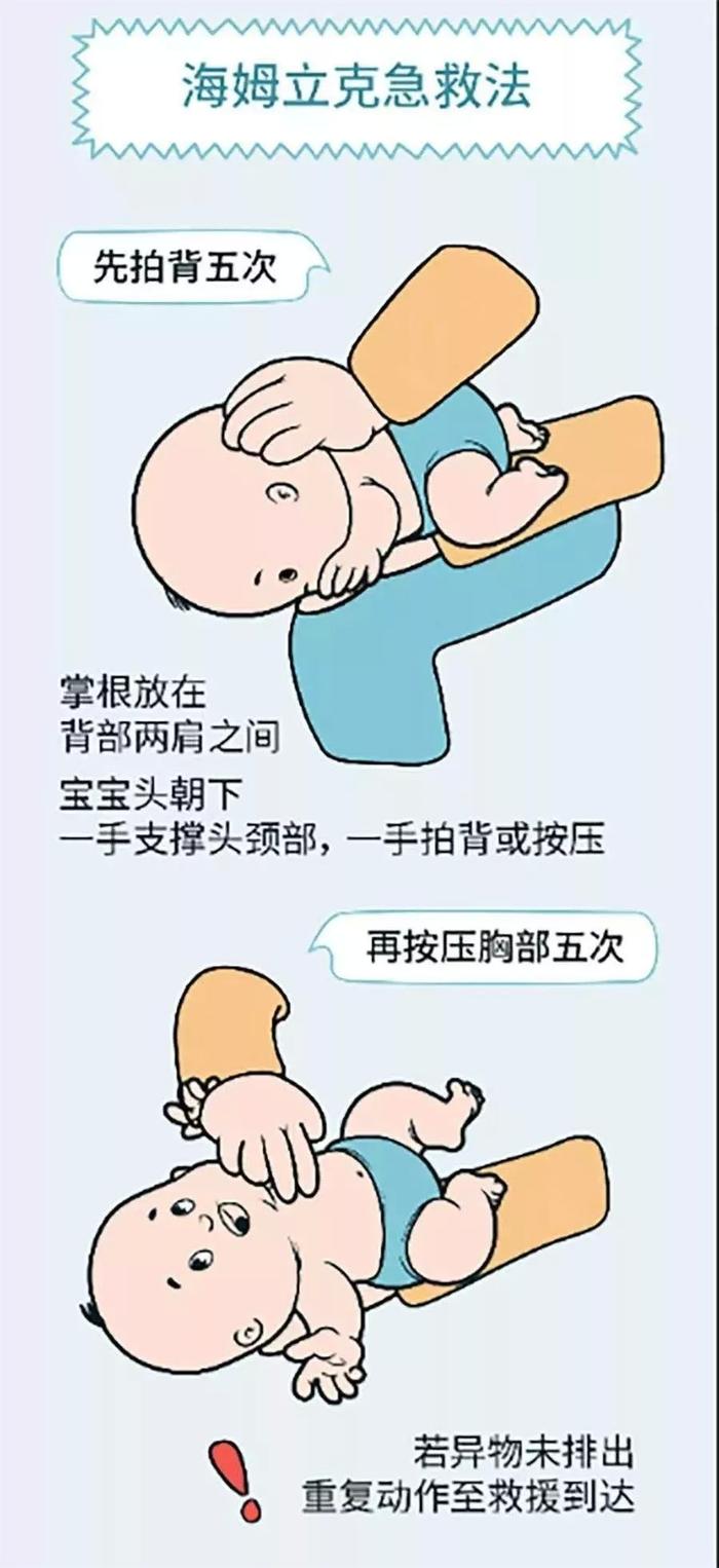 孩子窒息急救步骤与方法指南